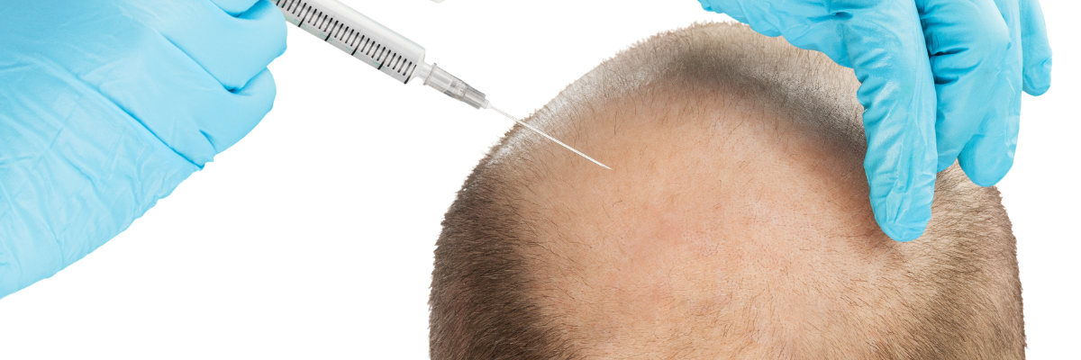 The Face Center - Hair Transplant Surgery | Hair