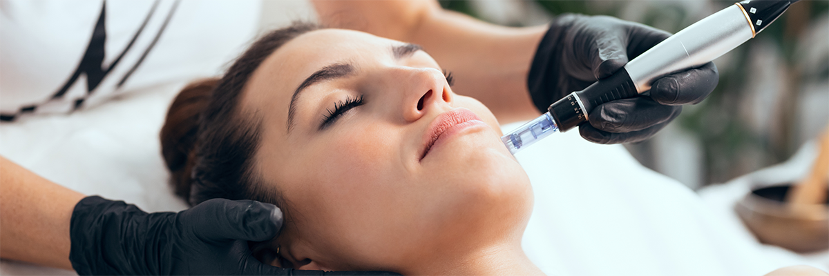 The Face Center - Microneedling | Skin