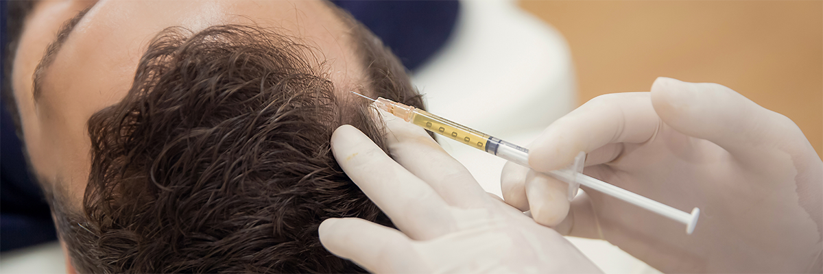 The Face Center - PRP/GFC Therapy | Hair