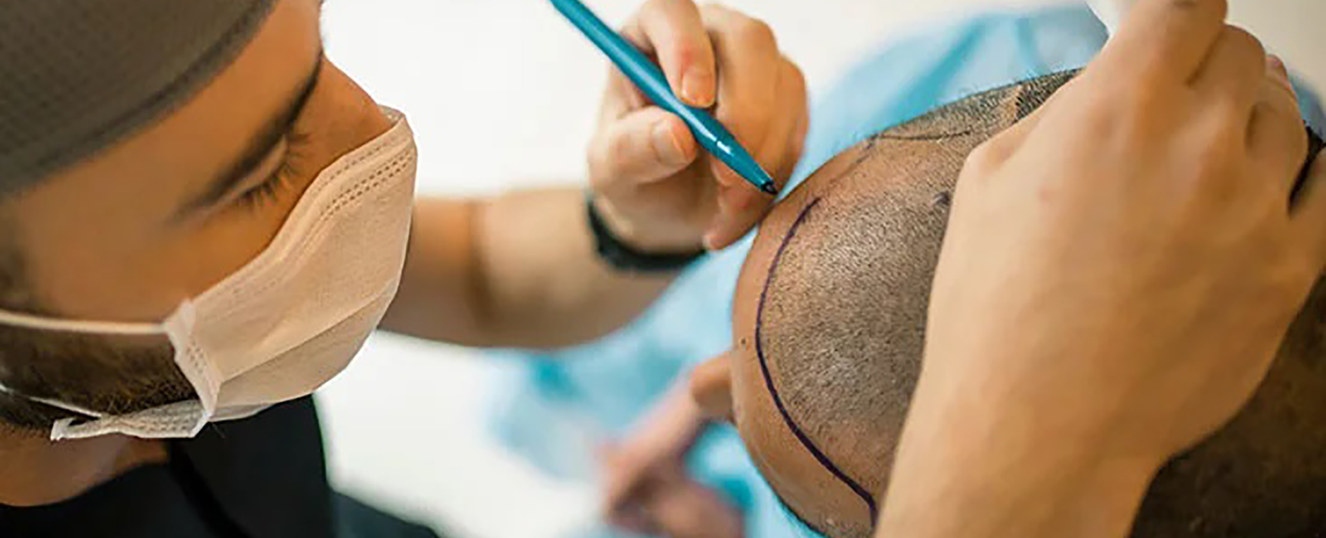 The Face Center - Hair Transplant Surgery | Hair Treatments