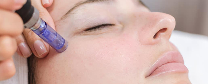 The Face Center - Microneedling | Aesthetic Treatments